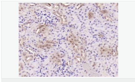 6052aa47315ea.png image.png