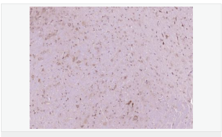 6052bc8f37b39.png image.png