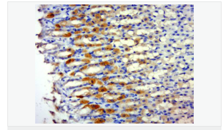 6063d4ed6632d.png image.png