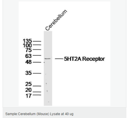 606571cbdf4ee.png image.png