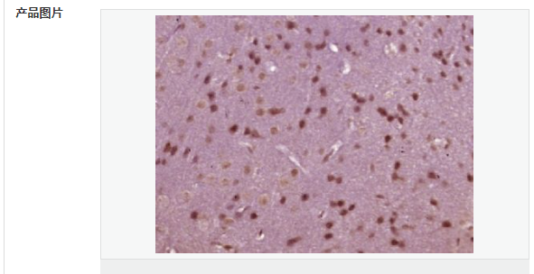 6076a98446782.png image.png